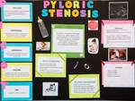 Pyloric Stenosis by Jenne Do Carmo RN, Amanda Zwyrbla RN, Danielle Hilliard RN, and Jennifer Kasperowski RN